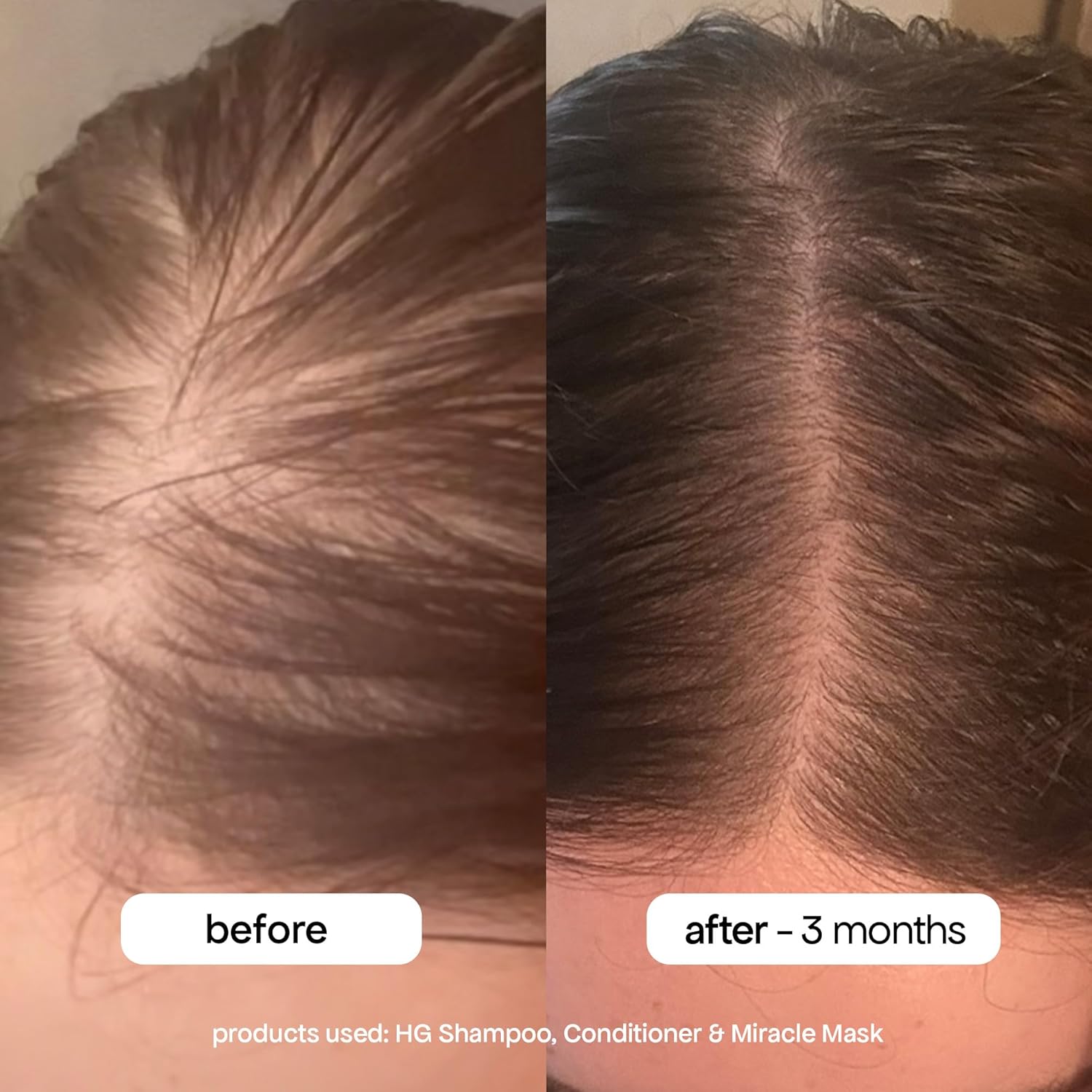 Reactivate Dormant Hair Follicles Naturally