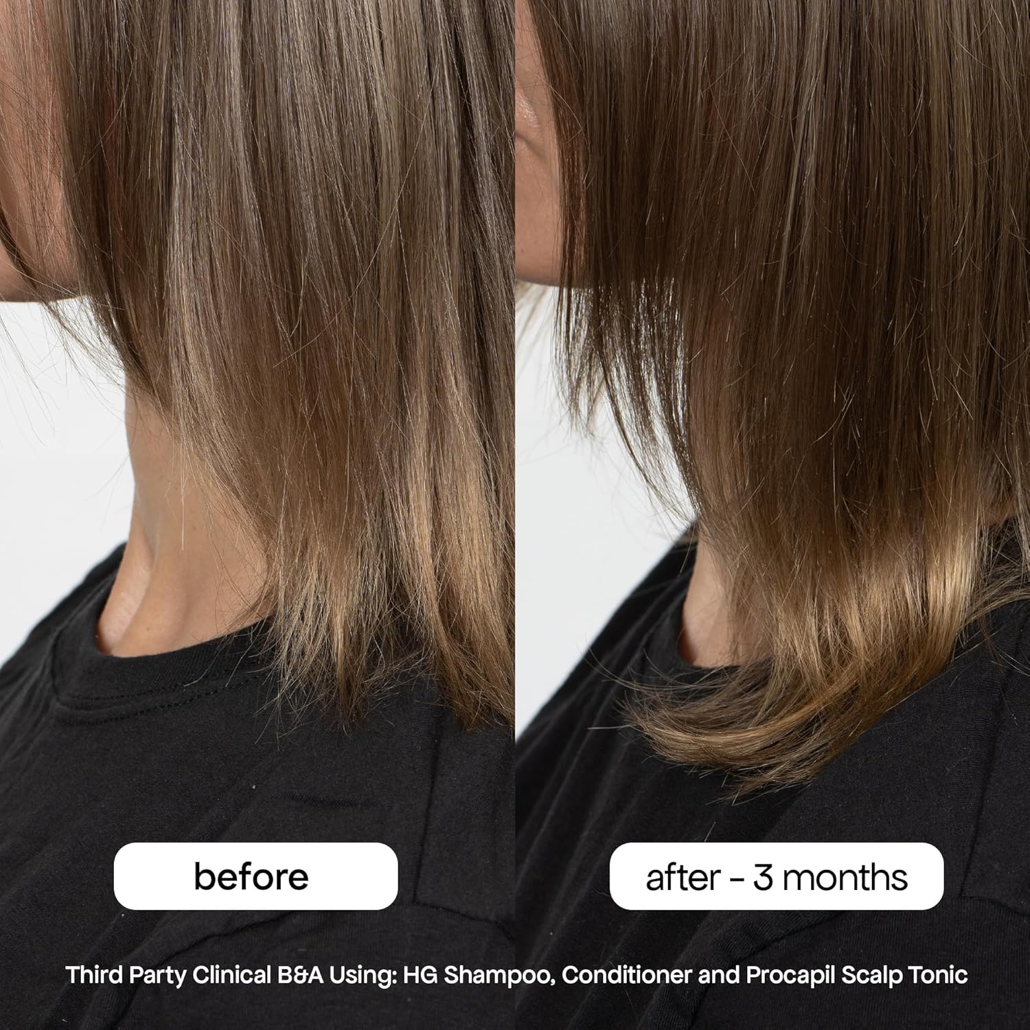 Stop Hair Loss at the Source